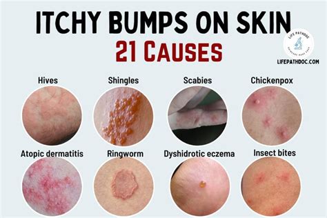 Itchy Bumps on Skin: 21 Causes, Pictures, and Treatment