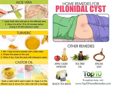 Home Remedies for Pilonidal Cysts (Large Pimple at Bottom of Tailbone ...