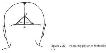 Posterior Fontanelle Size - Head Circumference - GUWS Medical