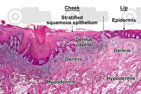 Man. Inside of the cheek. Vertical section. 32X - Mouth - Man - Mammals ...