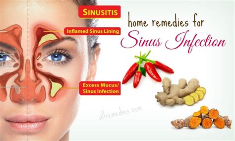 20 Best Natural Home Remedies for Sinus Infection in Adults