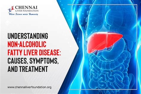 Understanding Non-Alcoholic Fatty Liver Disease: Causes, Symptoms, and ...