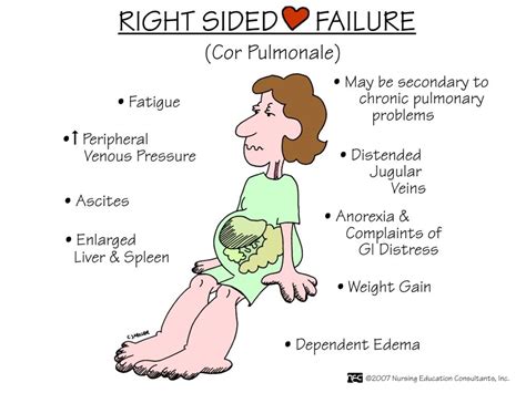 Symptoms of right sided heart failure vs left