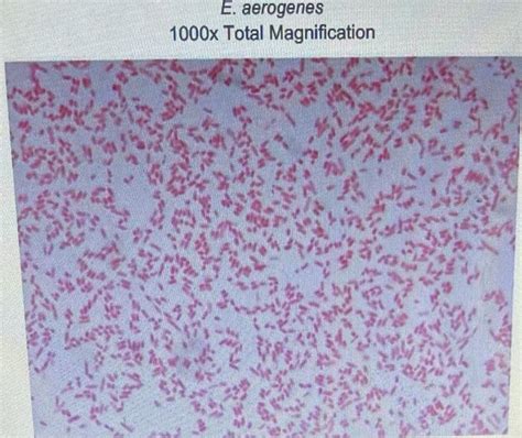 Solved Part 1: Gram Stain Procedure Procedure 1. Examine the | Chegg.com