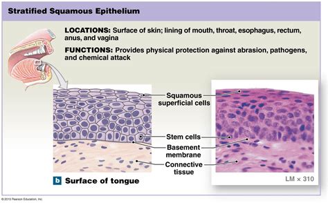 Stratified Squamous Keratinized Epithelium Labeled