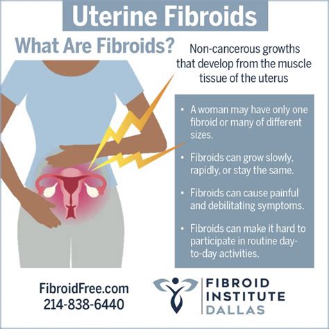 Symptoms from Fibroids: Margo’s Story | Fibroid Institute Texas