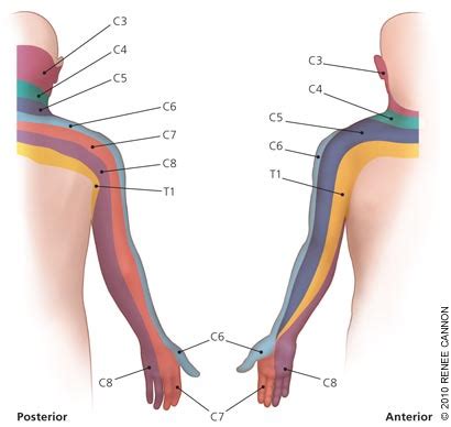 C7 8 nerve root compression