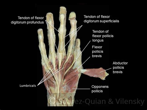 The Muscles of the Hand - Thenar - Hypothenar - TeachMeAnatomy