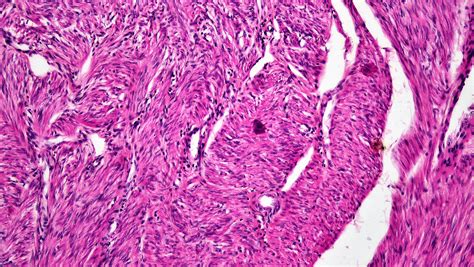 Mammalian Histology: Muscle Tissue – Berkshire Community College ...