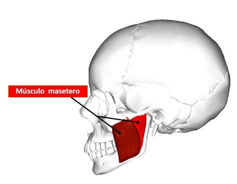 Infiltración del músculo masetero | Dolopedia