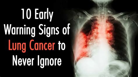 10 Early Warning Signs of Lung Cancer to Never Ignore