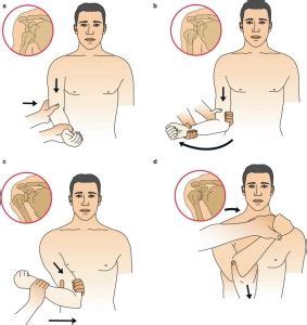 Disjointed – a quick update on shoulder dislocations