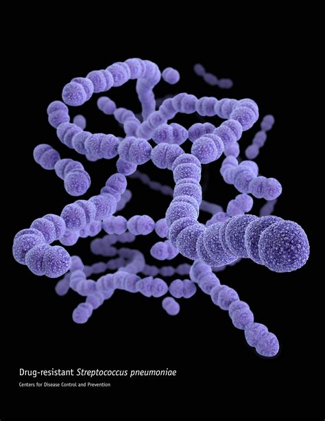 Scientific Name: Streptococcus Pyogenes Common Name: Strep Throat ...