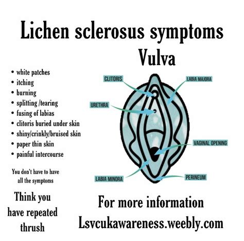 Lichen sclerosus symptoms | Lichen sclerosus, Lichen, Perineum