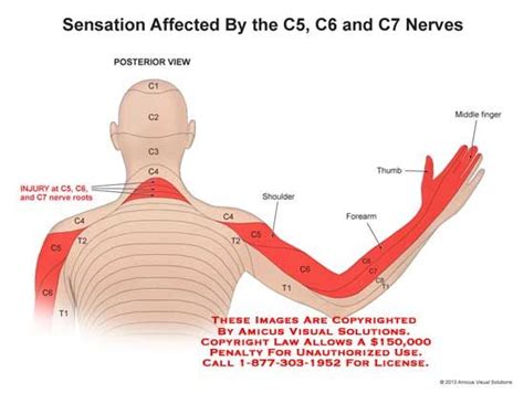 (13128_04X) Sensation Affected by the C5, C6, and C7 Nerves – Anatomy ...