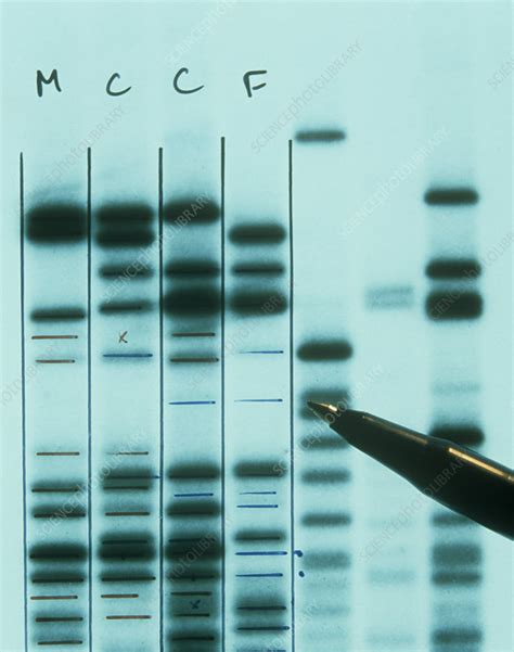 DNA fingerprinting - Stock Image - G210/0229 - Science Photo Library