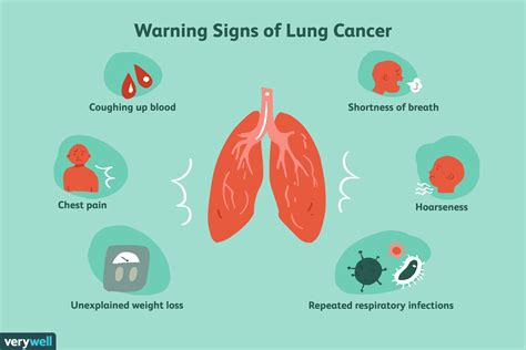 Lung Cancer Symptoms Coughing Up Phlegm - CancerWalls