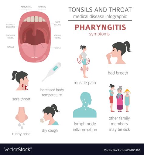 Tonsils and throat diseases pharyngitis symptoms Vector Image