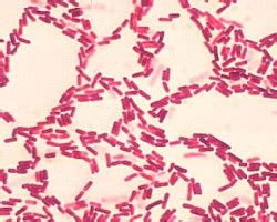 Bacillus Coagulans Gram Stain