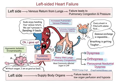 Heart Failure: Left sided VS Right sided - Creative Med Doses