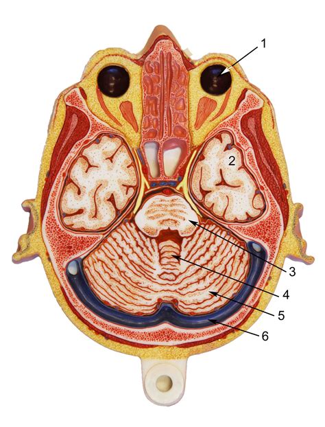 Brain Axial Section