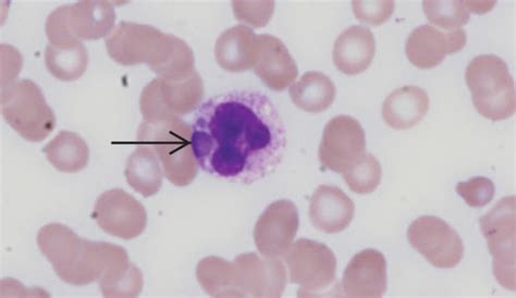 HOW TO AVOID THE FORMATION OF INCLUSION BODIES – Entomologenportal