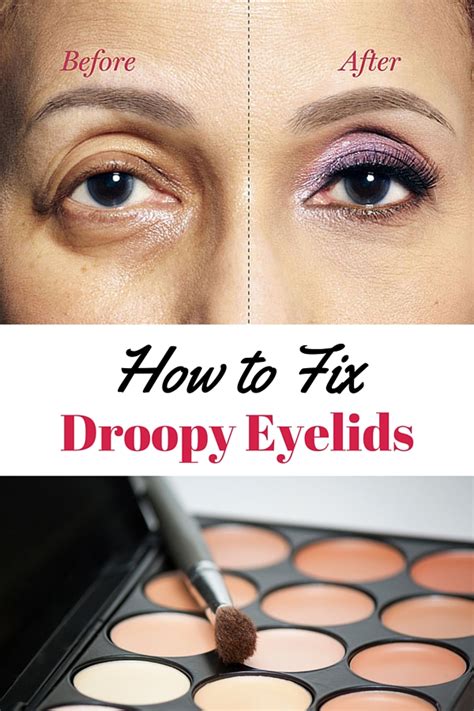 How to Fix Droopy Lids - How to Correct Drooping Eyelids