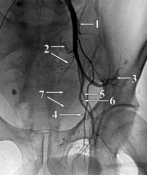 [DIAGRAM] External Iliac Artery Diagram - WIRINGSCHEMA.COM