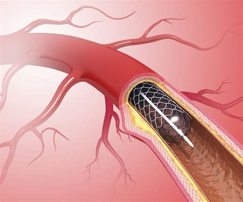 Pin on CARDIAC NOTES