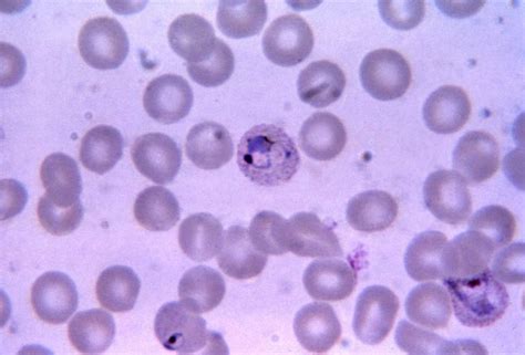 Free picture: young, growing, plasmodium vivax, trophozoite