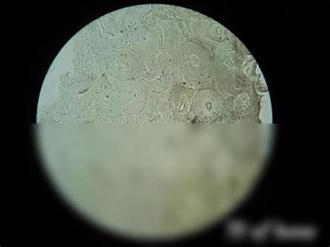 SOLUTION: Histology of transverse section of bone - Studypool