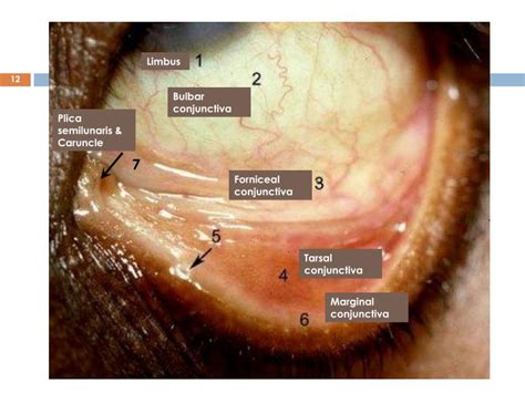 PPT - Review of clinical anatomy and physiology of the conjunctiva ...