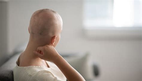 Chemotherapy Side Effects Hair Loss