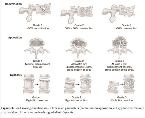 Lumbar Spine Fracture Types - Design Talk