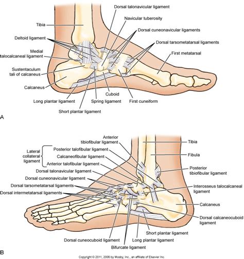 What is an inversion ankle sprain and what are its causes?