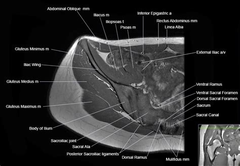 Ct Pelvis Anatomy Muscles Mri Anatomy Of Hip Joint Free Mri Axial ...