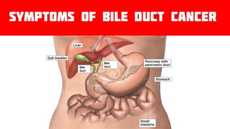 Acclimatize yourself with the symptoms of Bile duct cancer