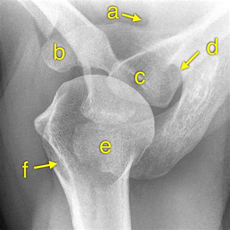 Scapula Anatomy Quiz