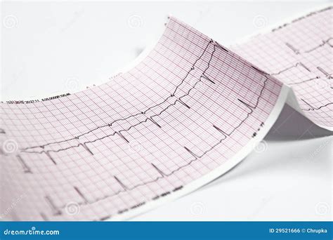 Electrocardiogram, Heart EKG Test Royalty Free Stock Image - Image ...