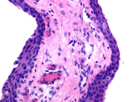 Pathology Outlines - Anatomy & histology-conjunctiva