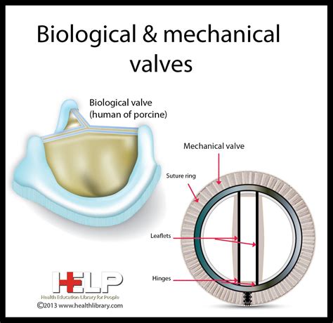 Valvole cardiache: in via di sviluppo un’innovativa protesi tissutale ...