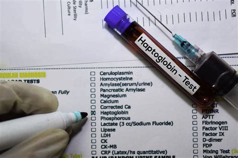 Haptoglobin - Test With Blood Sample. Top View Isolated On Office Desk ...