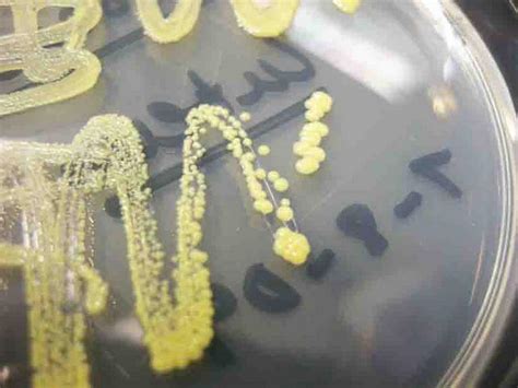 staphylococcus aureus bacteria morphology