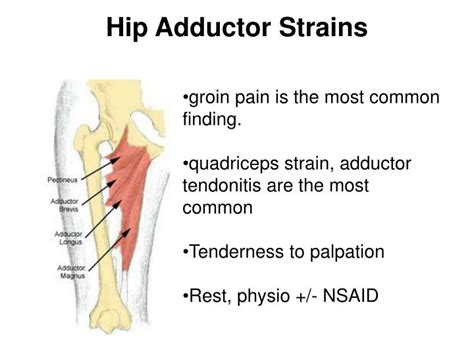 PPT - Trochanteric Bursitis PowerPoint Presentation - ID:1209260