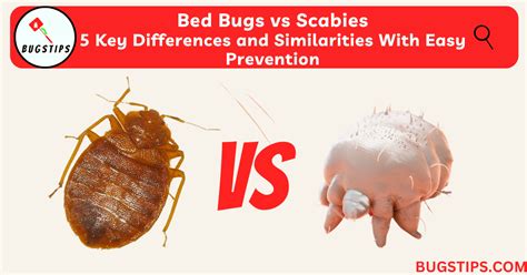 Bed Bugs vs Scabies - 5 Key Differences and Similarities With Easy ...