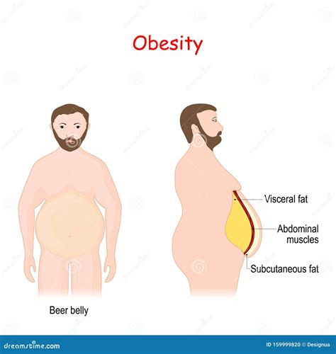 Visceral Fat And Subcutaneous Fat That Accumulate Around Your Waistline ...