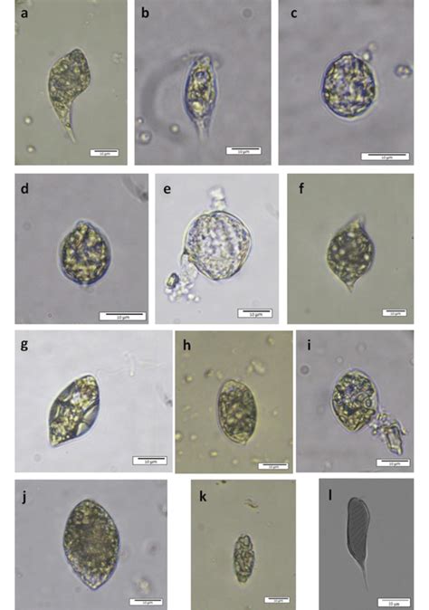 Euglenozoa; a) Euglenaria anabaena, b) Euglenopsis vacuolata, c ...