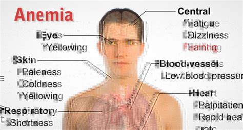 Main Symptoms Of Iron Deficiency And Tips For Increasing The Iron Levels