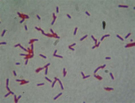 Endospore stains of Bacillus thuringiensis: A) DI-29, B) C-18 ...