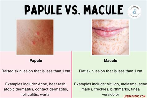 Papule vs Macule: Pictures, Differences, and Causes